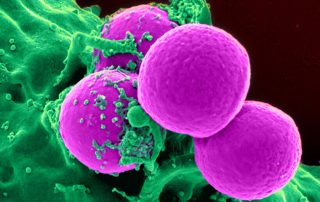 estafilococo aureusalimentos